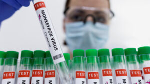 EE.UU. declara emergencia de salud pública por brote de viruela del mono