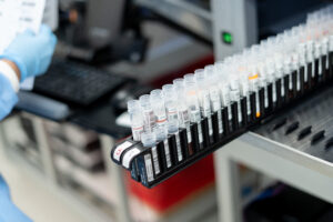 Laboratorio Referencia dispone de pruebas para detección de viruela del mono
