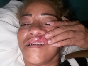 Mujer denuncia expareja intentó ahorcarla en El Vigiador de Montecristi