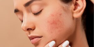 Lo que debemos  saber sobre lupus: una enfermedad multisistémica