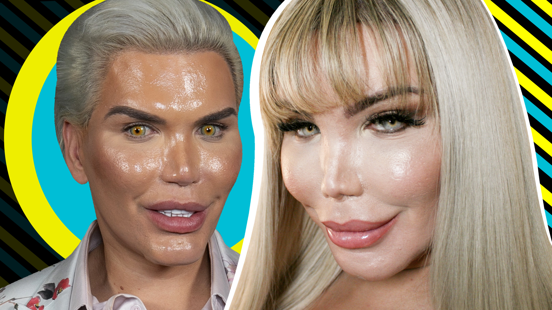 Gastó un millón de dólares para parecerse a Ken y ahora quiere ser Barbie