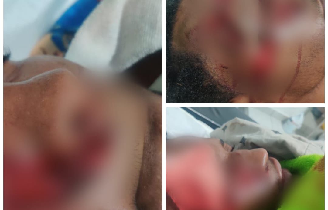 Denuncian hombre golpeó varias personas que lo acusan de vender drogas