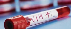Inician programa de detección de VIH y COVID-19 en cárceles de La Victoria y Najayo