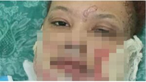 Madre pide justicia por hija en coma tras ser quemada con gasolina