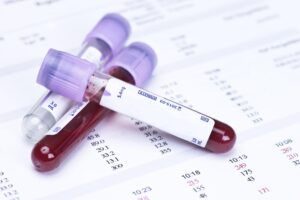 Un nuevo análisis de sangre puede detectar proteínas «tóxicas» años antes de que aparezcan los síntomas de la enfermedad de Alzheimer