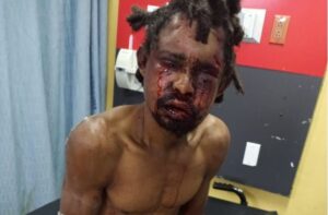 Policía dio de baja a presunto delincuente 