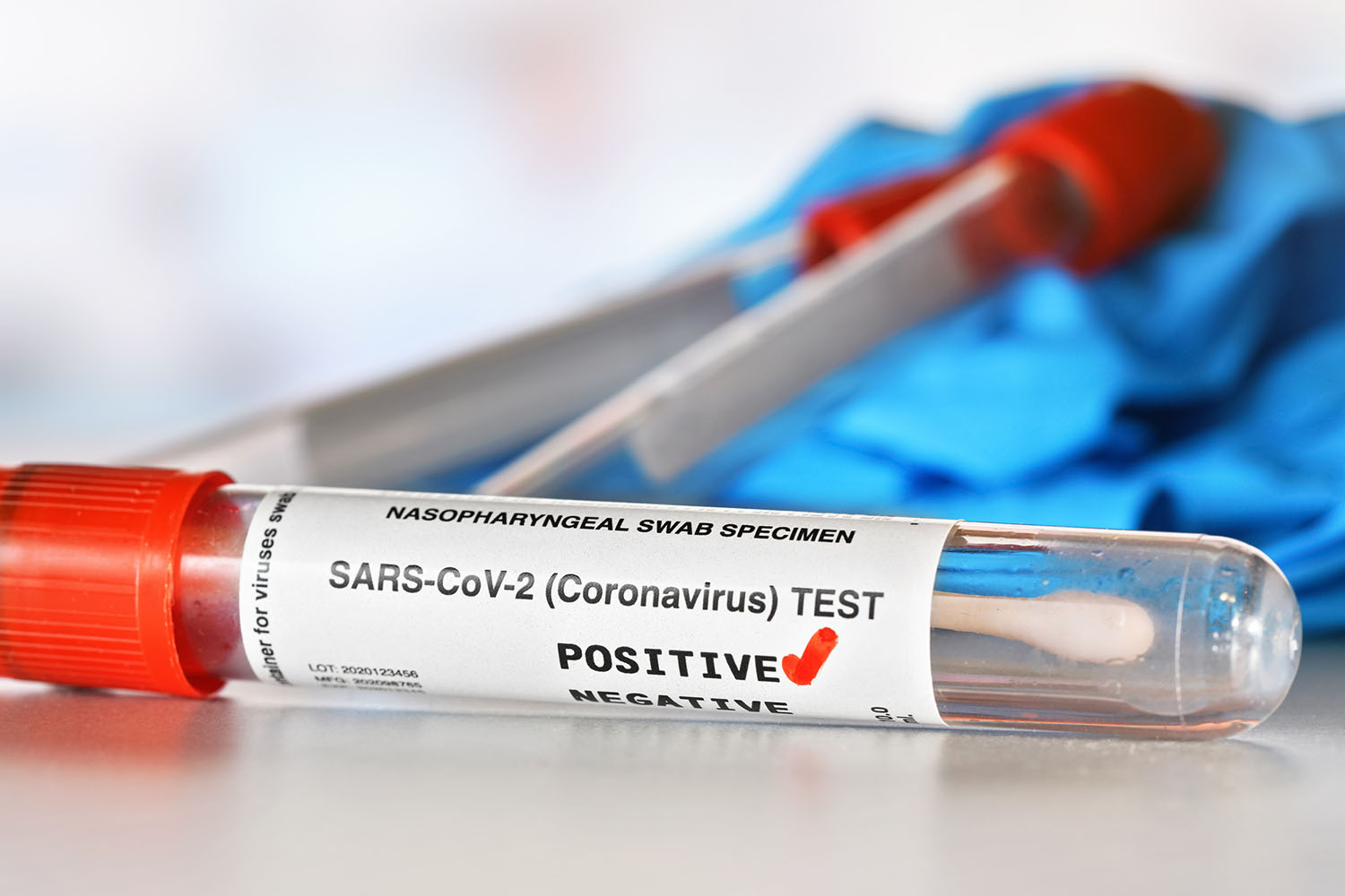 OMS pide a los países que mantengan la vigilancia del virus de la covid-19 de COVID-19 sin defunciones