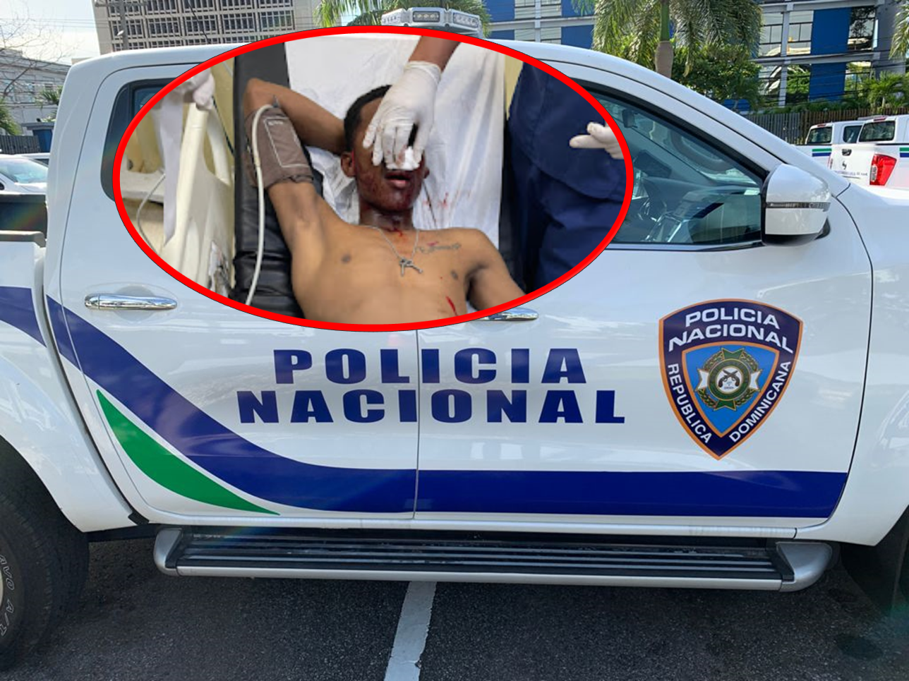 Agente PN resulta herido por oficial retirado que ayudaba a detener supuesto delincuente