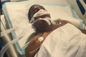 Chofer de yipeta atropellado por conductor de autobús se encuentra delicado 
