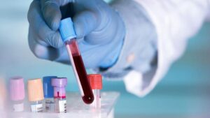 28 de julio: Día Mundial contra la Hepatitis 