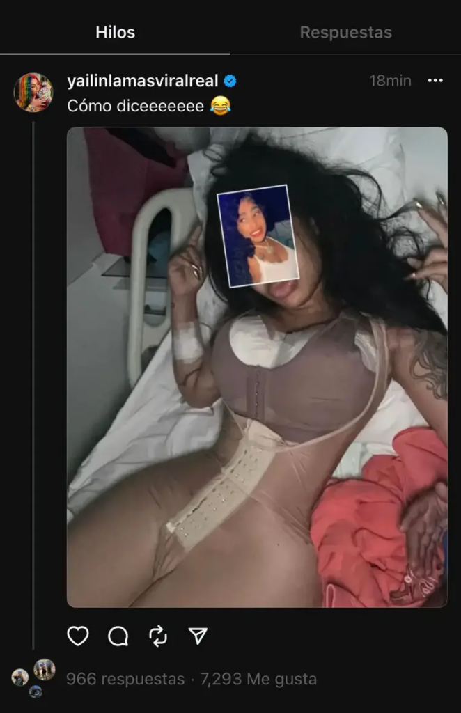 Así quedó Yailin La Más Viral tras su cirugía de cumpleaños