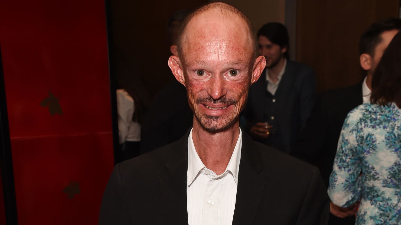Muere a los 36 años actor de 'Juego de Tronos' Darren Kent