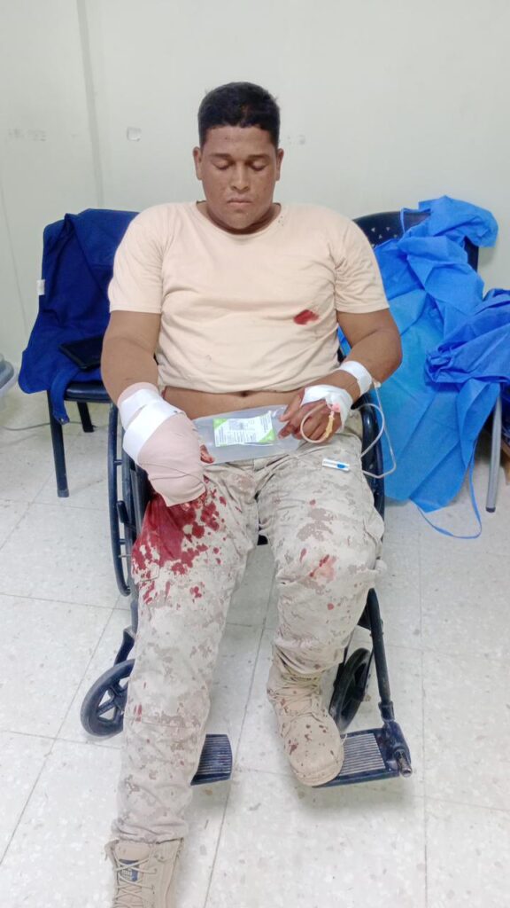 Haitianos hieren y despojan de escopeta a miembro de la FARD asignado a Cesaron
