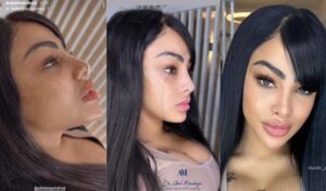 Respirando nuevos aires: Todo lo que debes saber sobre la nueva nariz de Yailin y su armonización facial  