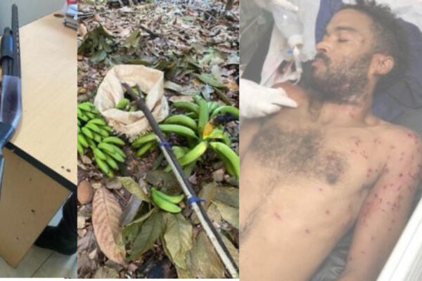 Hombre propina cartuchazo a otro tras sorprenderlo supuestamente robando plátanos  