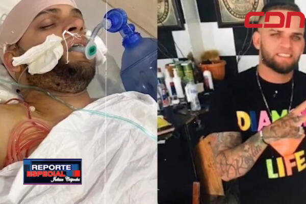 Richard Báez fue golpeados después de estar detenido.
Foto: CDN Digital