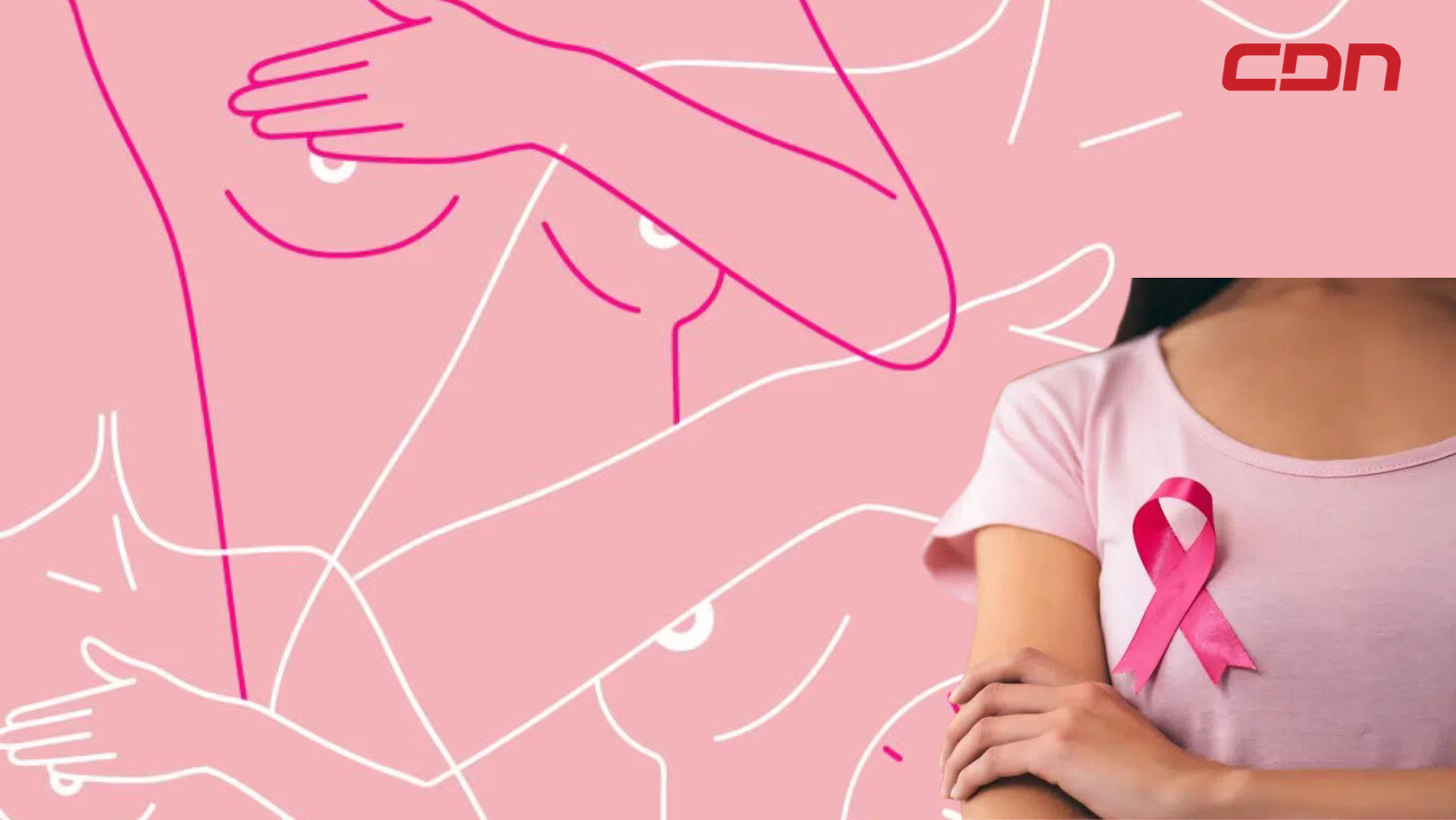 Cáncer de Mama
