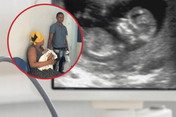 Se trató de error sonográfico información sobre mellizos
