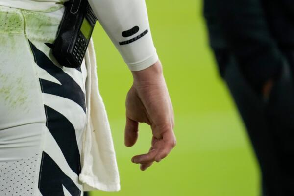 Muñeca lesionada del quarterback de los Bengals, Joe Burrow. FOTO: Fuente externa.