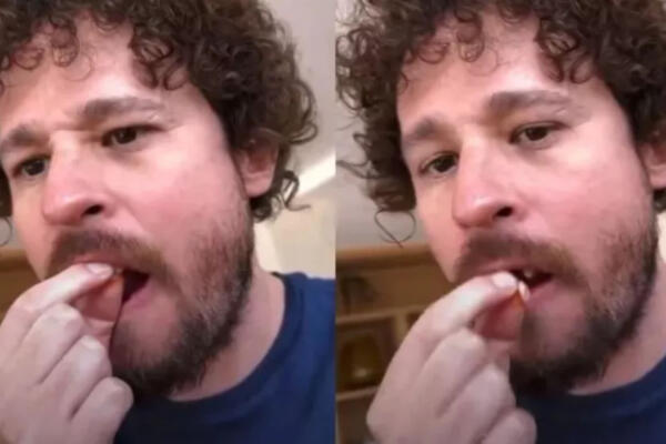 Mediante un video en vivo quedo captado el momento en el Luisito Comunica pierde algunos de sus dientes. FOTO: Fuente externa