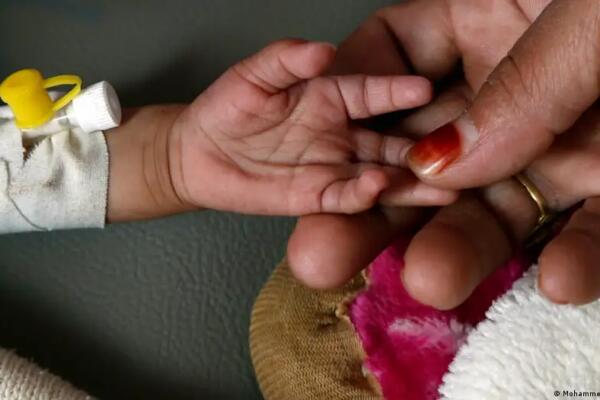 Imagen simbólica del hambre infantil. Fuente:Externa.