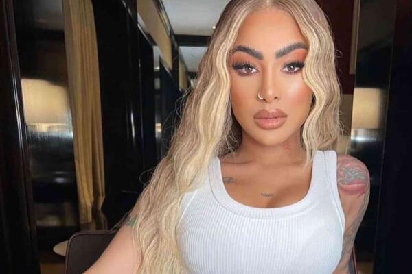 Yailin La Más Viral aparece golpeada en la cara, ¿qué le pasó?