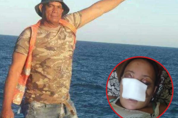 Este es Máximo Peralta acusado de propinar golpiza a Yuberky Martínez. Foto: CDN digital. 