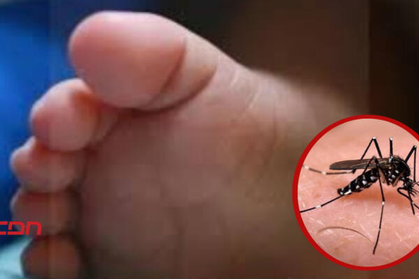 Fallece niño de dengue en SFM. (Foto: CDN Digital)