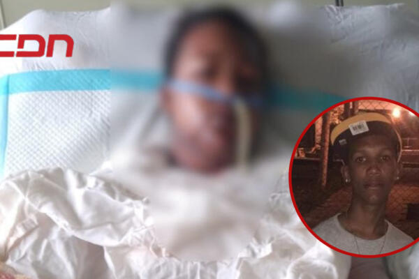 Según versiones no es primera vez que la víctima es agredida por su pareja. (Foto: CDN Digital) 