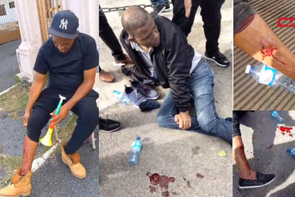Varios policías retirados heridos en protestas de la 27 de Febrero. Foto: CDN