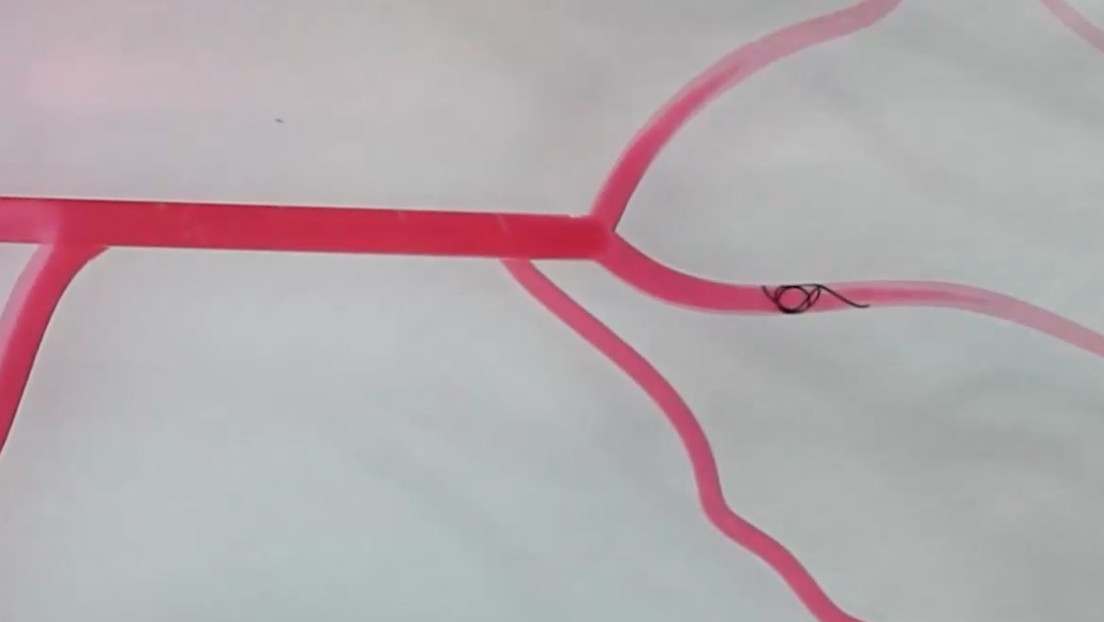 Los creadores de este dispositivo publicaron sus resultados en Science Robotics. Fuente: Fuente Externa