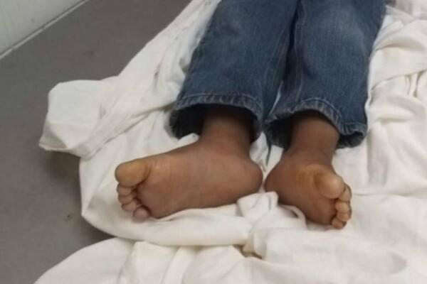 Madre lanza machetazo a su pareja y quien alcanza es a su hijo. (Foto: Fuente externa).