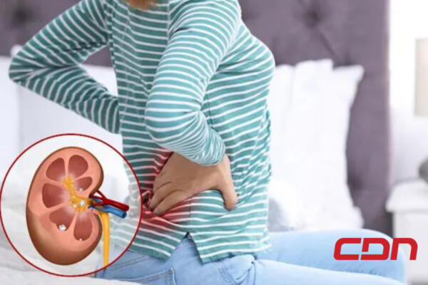 Aunque no lo parezca, el 10% de la población mundial sufre de alguna enfermedad de los riñones o renal crónica. Foto: fuente externa.