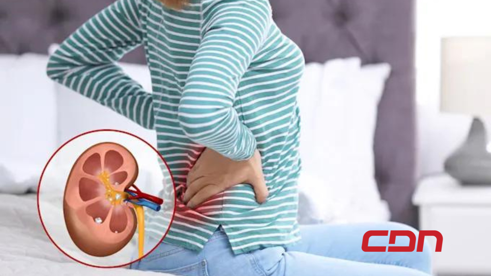 Aunque no lo parezca, el 10% de la población mundial sufre de alguna enfermedad de los riñones o renal crónica. Foto: fuente externa.