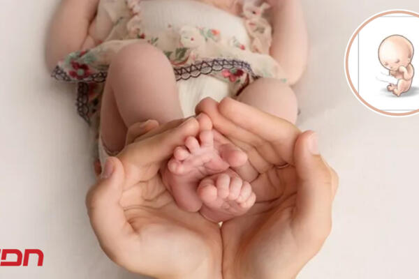 El Síndrome de Edwards o Trisomía 18, es un desorden genético donde los niños, al nacer, presentan un cromosoma extra en el par 18. Foto: CDN digital
