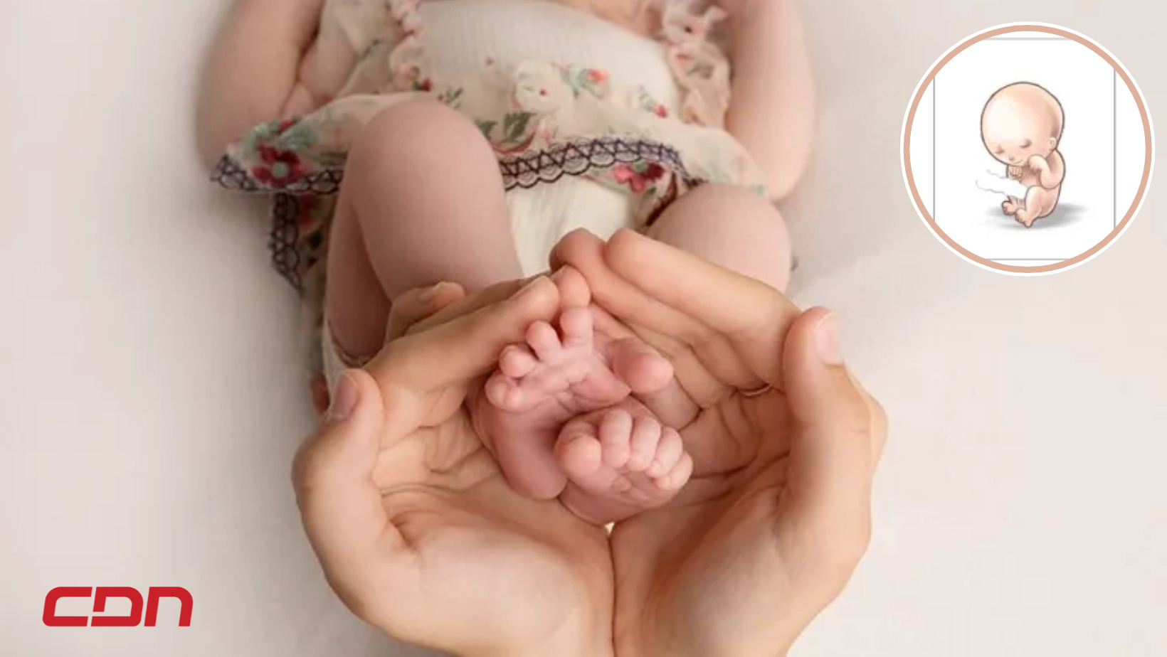 El Síndrome de Edwards o Trisomía 18, es un desorden genético donde los niños, al nacer, presentan un cromosoma extra en el par 18. Foto: CDN digital