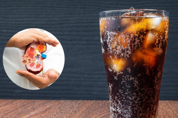 Mito o Verdad: ¿Son los refrescos un peligro para la salud renal?