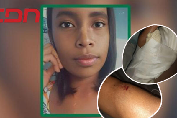 Desconocido penetra a vivienda tratando de matar a una madre en Monte Plata