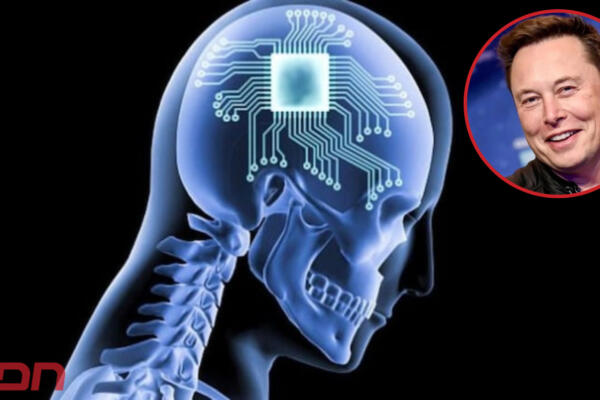 El CEO de Tesla Motors, Elon Musk dice que su empresa Neuralink puede devolver la vista a los monos. Foto: CDN Digital