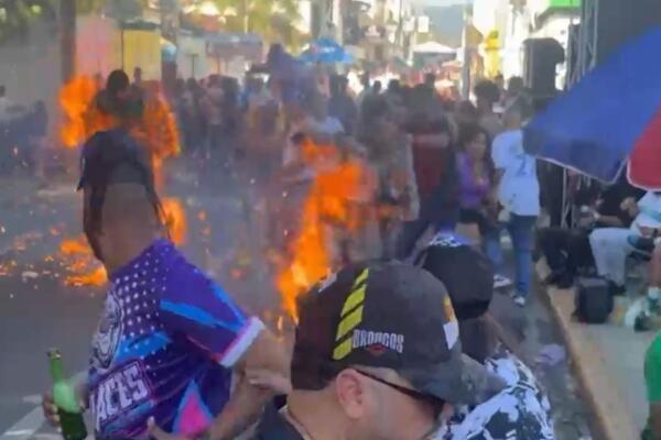 Varios niños quemados por fuegos artificiales en carnaval de Salcedo