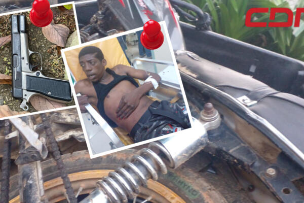 Presunto delincuente herido al enfrentar patrulla policial. Foto CDN Digital