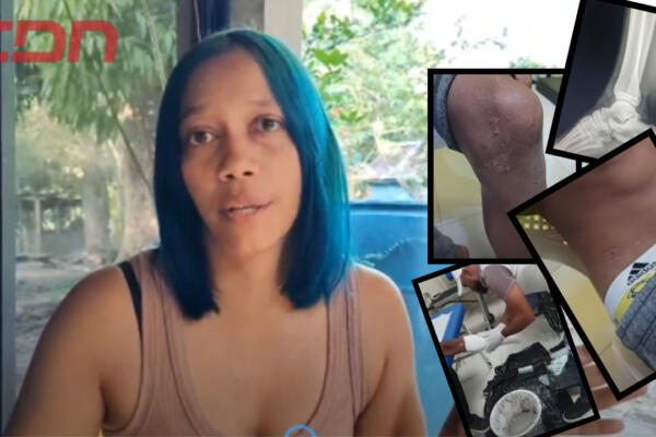 Madre denuncia autoridades hacen caso omiso a denuncia de agresión contra su hijo. Foto CDN Digital