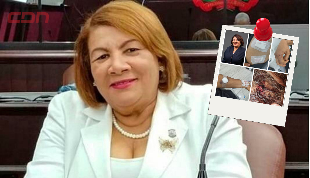 Cleo Sánchez fue herida por un extraño dentro de su hogar