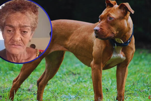 La señora que fue atacada por un perro de la raza Pit Bull. Foto: CDN Digital