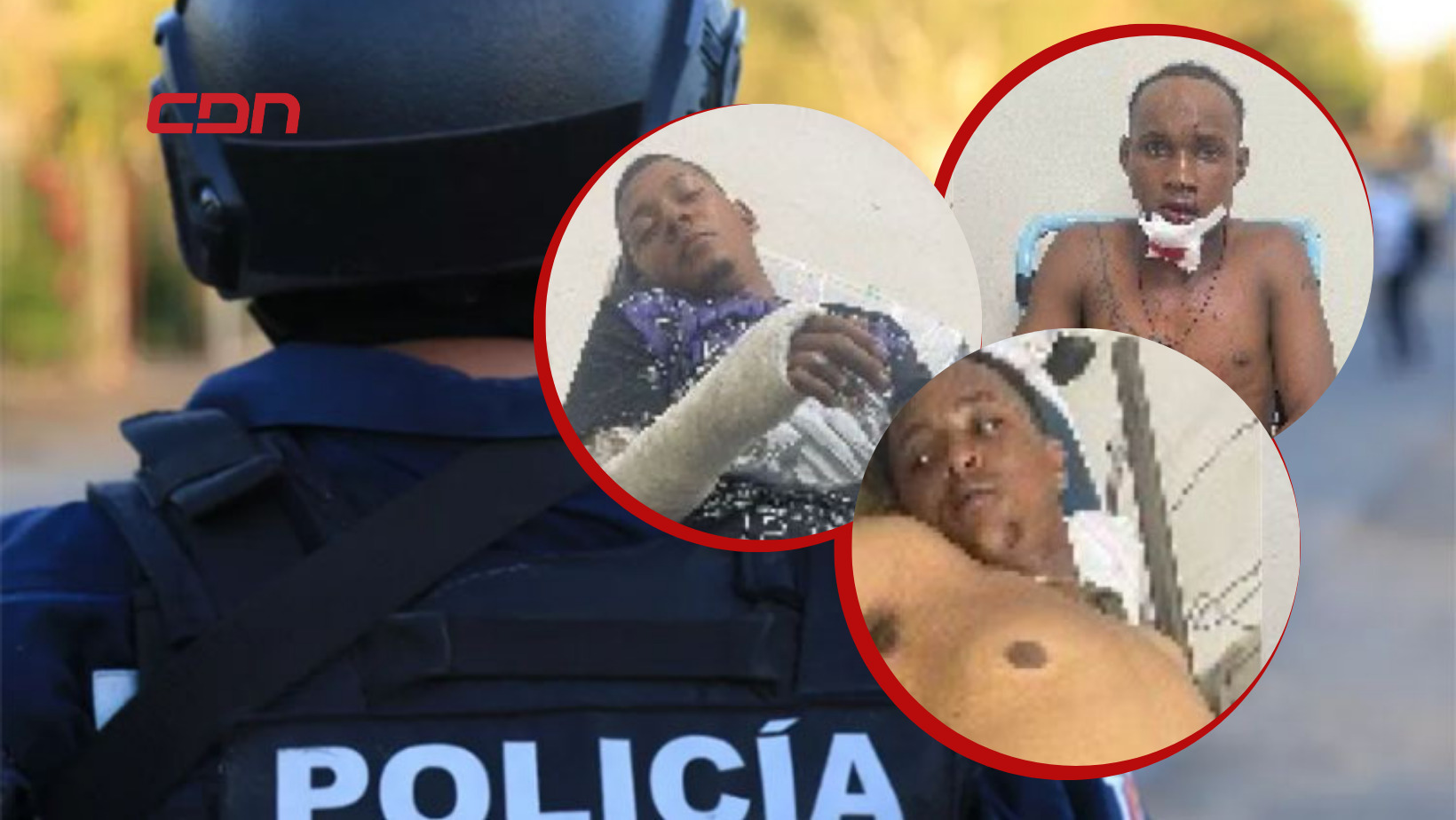 Tres presuntos delincuentes resultaron heridos tras persecución en Constanza
