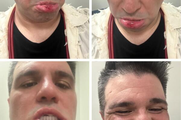 Vladimir Gómez, periodista golpeado
Foto: fuente externa