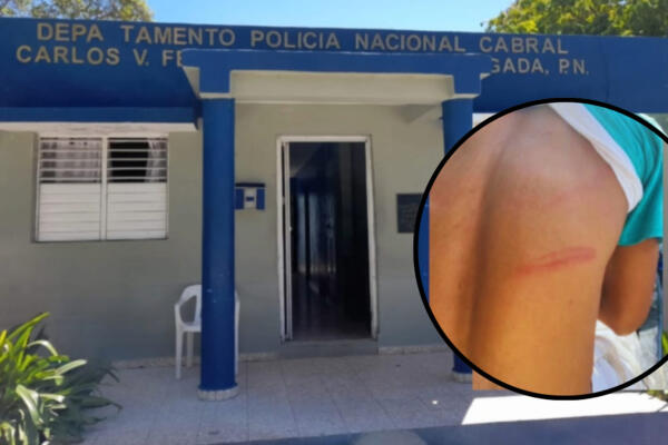 José Antonio de la Paz fue golpeado por un coronel de la PN. Foto: Fuente externa