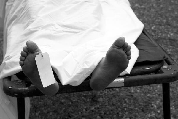 El hombre fue asesinado lo asesinaron pese a este presentar condiciones especiales