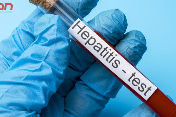 Es  una inflamación del hígado que puede ser causada por diversos factores. Foto: Fuente externa 