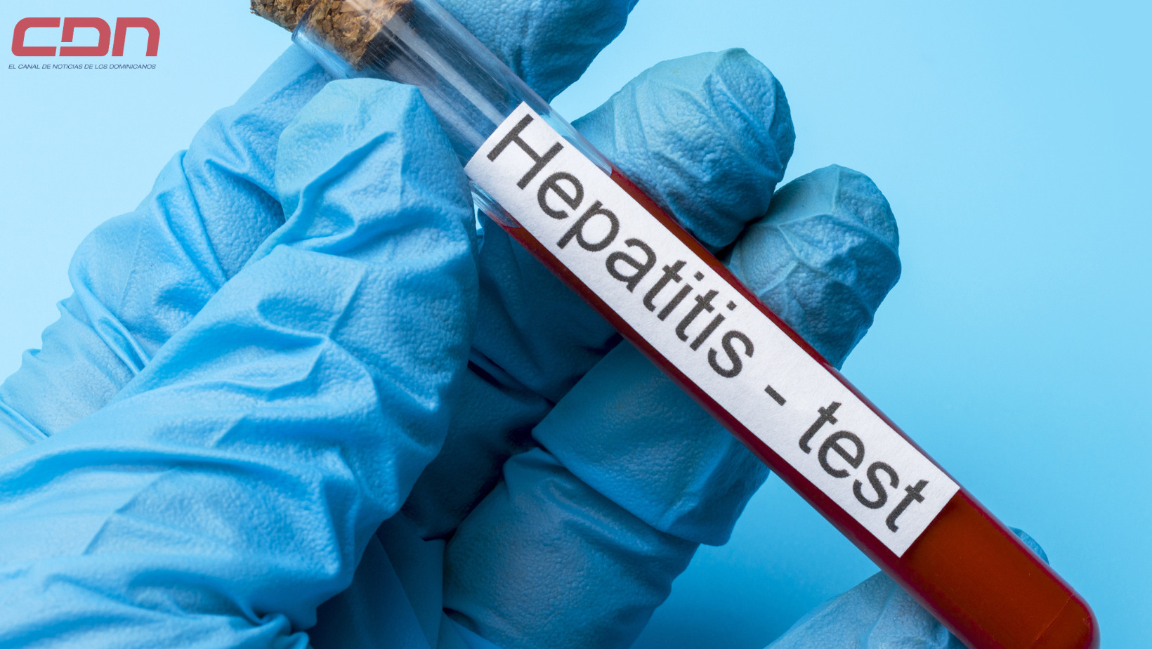 Hepatitis